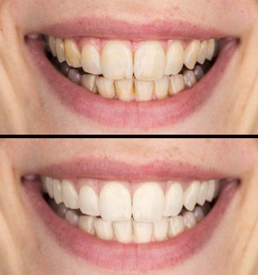 Dentistas Cerdanyola del Vallès