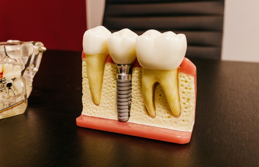 Dentistas en Corbera de Llobregat