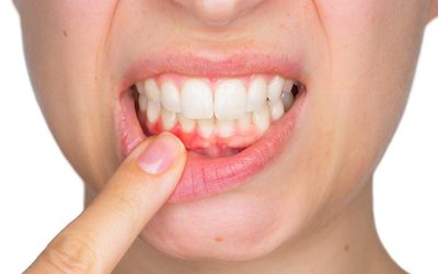 Dentistas en Sant Joan Despí
