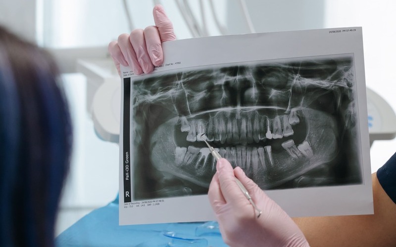 Dentistas en Sant Cugat