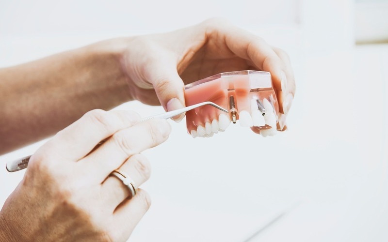 Dentistas Mollet del Vallès