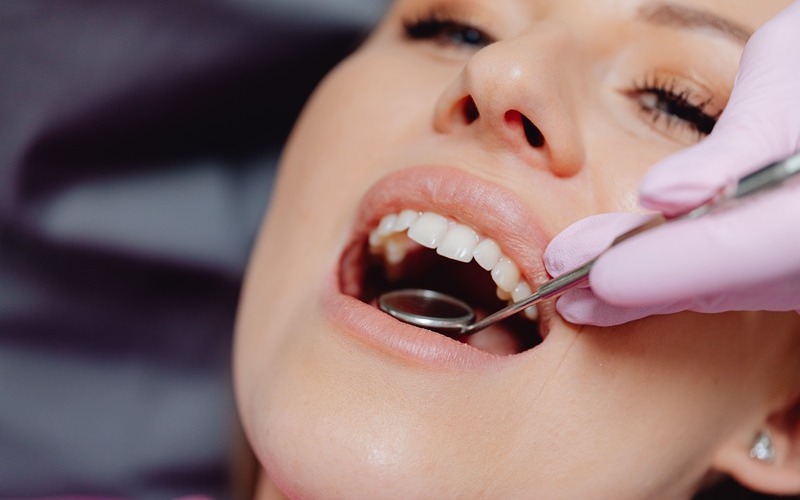 Qué es el stripping dental en ortodoncia